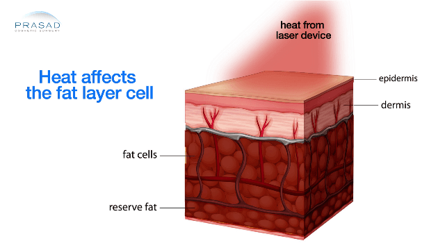Heating Device on Skin