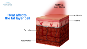 Heating affects the fat layer cell illustration