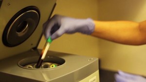 Platelet-rich plasma preparation through a centrifuge by Dr. Amiya Prasad