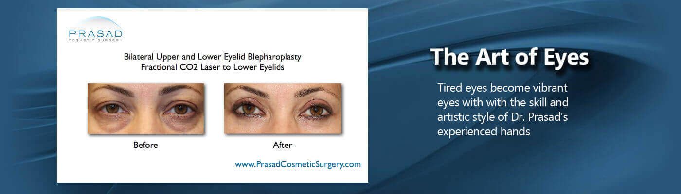 Eyelift Surgery Specialist Dr Amiya Prasad New York